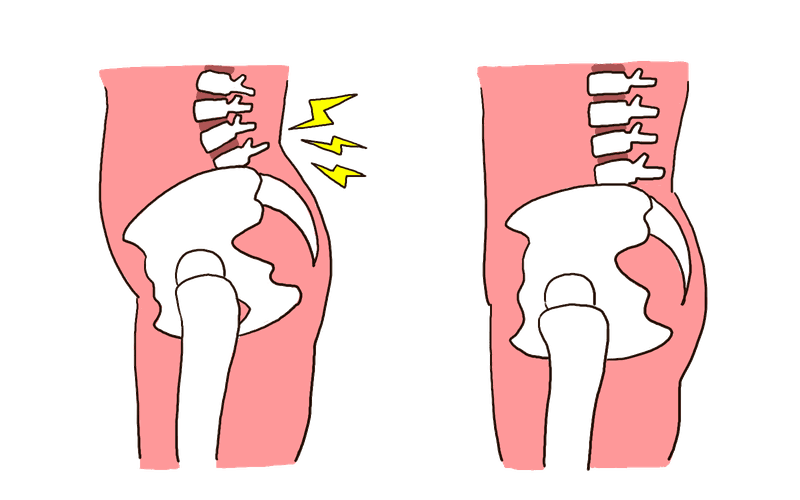 腰痛に悩む中高年のイラスト